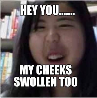 hey-you.......-my-cheeks-swollen-too