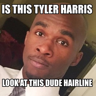 is-this-tyler-harris-look-at-this-dude-hairline