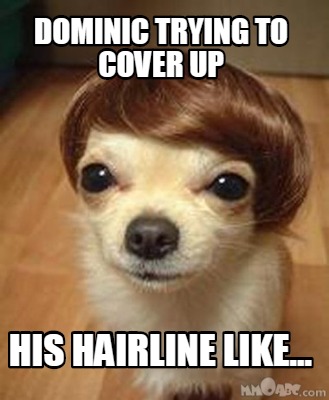 dominic-trying-to-cover-up-his-hairline-like