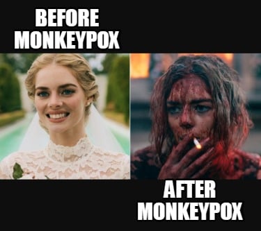 before-monkeypox-after-monkeypox