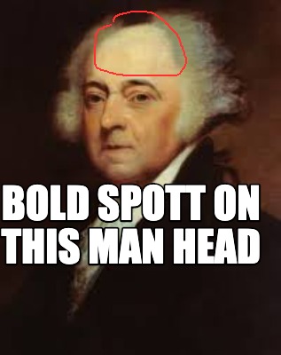 bold-spott-on-this-man-head