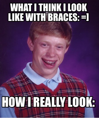 what-i-think-i-look-like-with-braces-how-i-really-look
